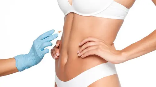 plastiek na uitholling