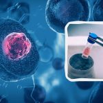 Stamceltherapie: het eerste land ter wereld dat een dergelijke therapie